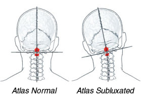 atlas orthogonal